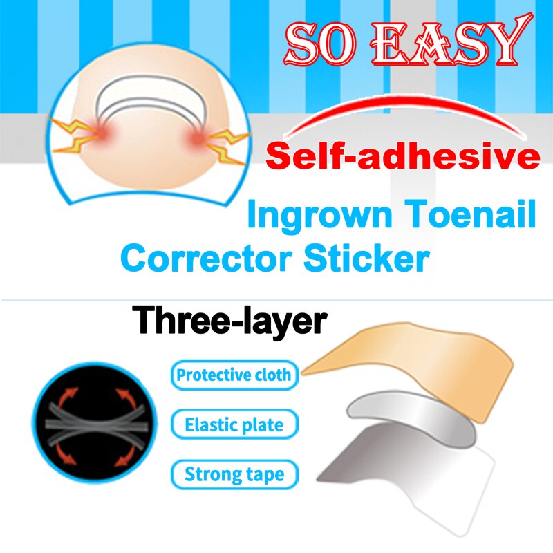 Ingrown Toenail Correct Patches™