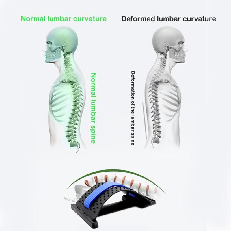 Posture Correcting Back Stretcher